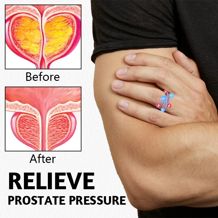 (✨LAST DAY SALE-82% OFF✨) Miniyou™ Prosta Magnetic Harmony Ring