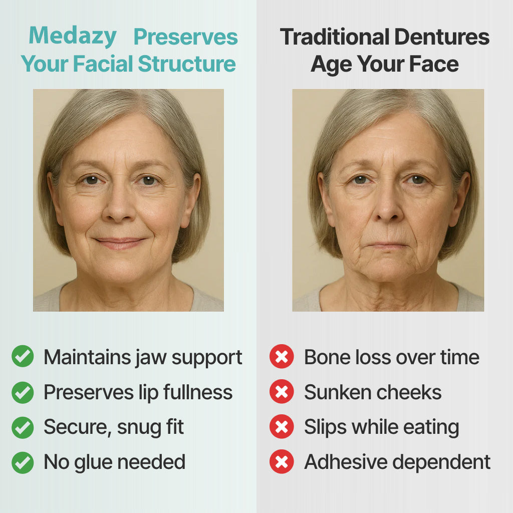 【OFFICIAL STORE】Medazy™ Custom-Fit Full Functional Dentures✨