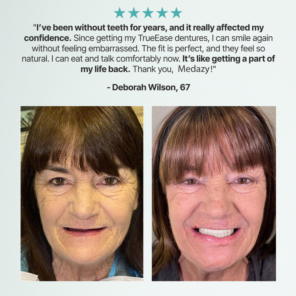 Medazy? Custom-Fit Full Functional Dentures