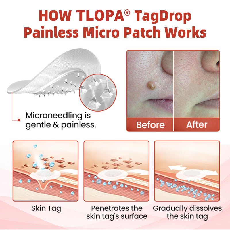 𝗧𝗟𝗢𝗣𝗔® Tag Drop ✨ Painless Micro Patch (AAD Recommended👨‍⚕️)🧡