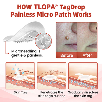 𝗧𝗟𝗢𝗣𝗔® Tag Drop ✨ Painless Micro Patch (AAD Recommended👨‍⚕️)🧡