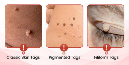 𝗧𝗟𝗢𝗣𝗔® Tag Drop ✨ Painless Micro Patch (AAD Recommended👨‍⚕️)🧡