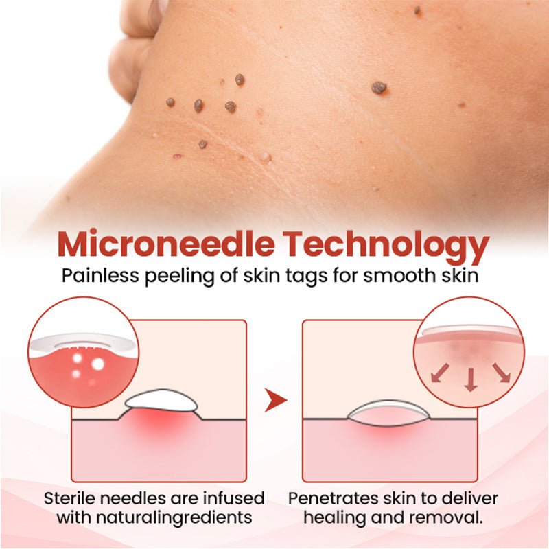 𝗧𝗟𝗢𝗣𝗔® Tag Drop ✨ Painless Micro Patch (AAD Recommended👨‍⚕️)🧡