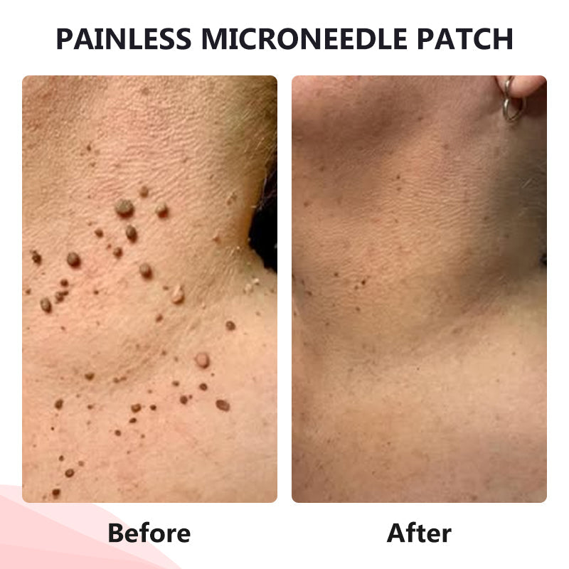 𝗧𝗟𝗢𝗣𝗔® Tag Drop ✨ Painless Micro Patch (AAD Recommended👨‍⚕️)🧡