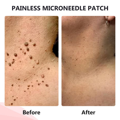 𝗧𝗟𝗢𝗣𝗔® Tag Drop ✨ Painless Micro Patch (AAD Recommended👨‍⚕️)🧡