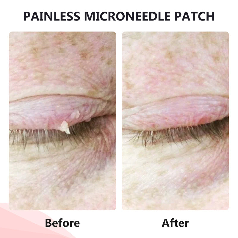 𝗧𝗟𝗢𝗣𝗔® Tag Drop ✨ Painless Micro Patch (AAD Recommended👨‍⚕️)🧡