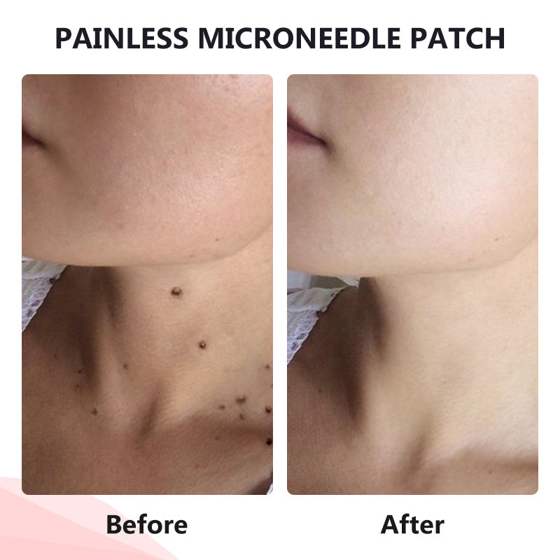 𝗧𝗟𝗢𝗣𝗔® Tag Drop ✨ Painless Micro Patch (AAD Recommended👨‍⚕️)🧡