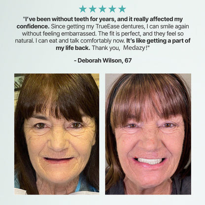 Medazy? Custom-Fit Full Functional Dentures